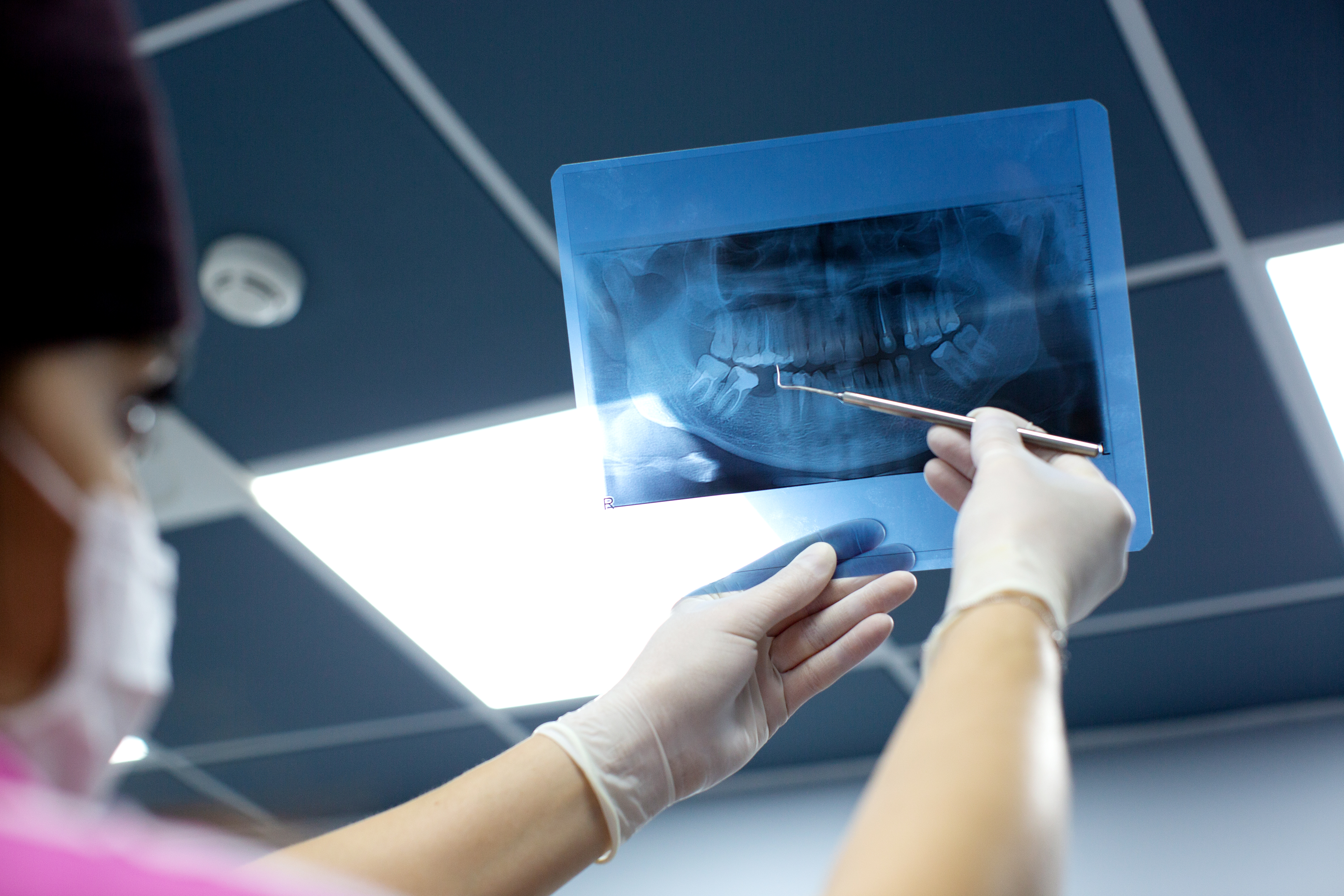 Dental X-Ray Service